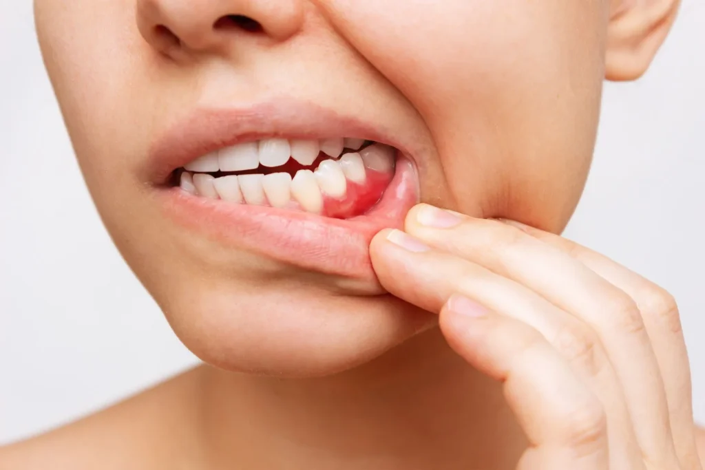 4 Common Dental Problems and How to Prevent Them