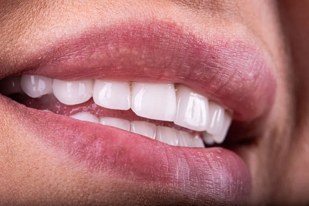 Restorative Dentistry: Repairing and Replacing Missing Teeth