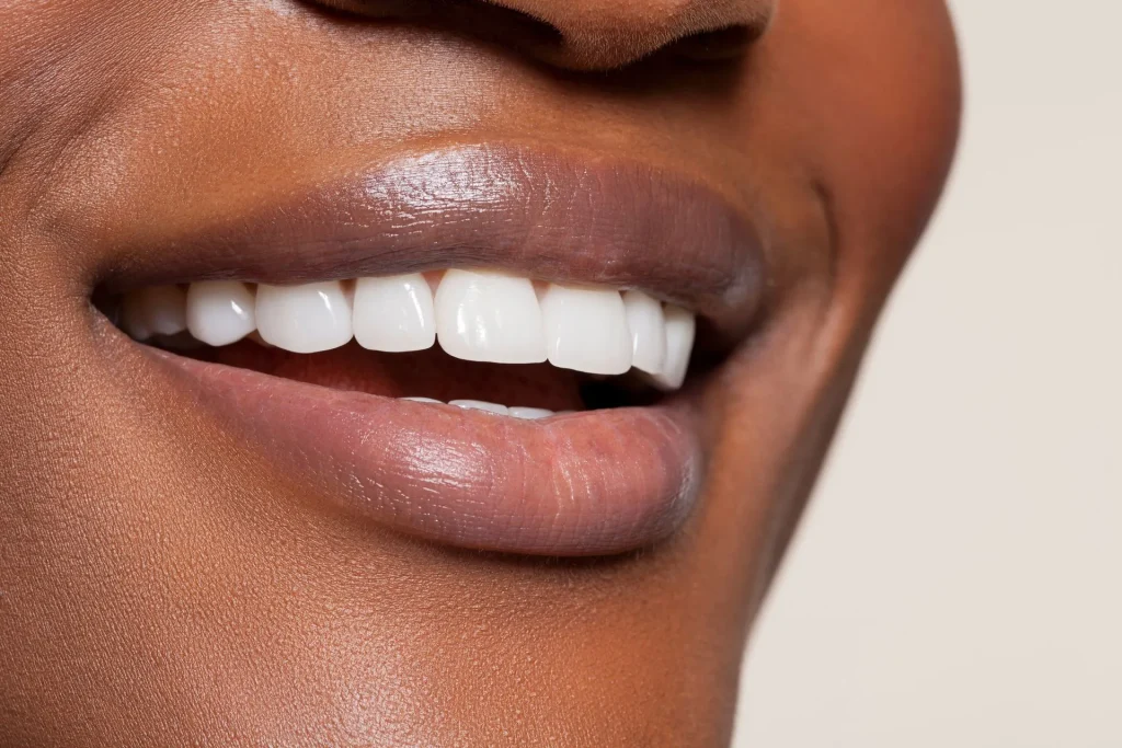 Smile Makeovers: Transforming Your Smile through Cosmetic Dentistry