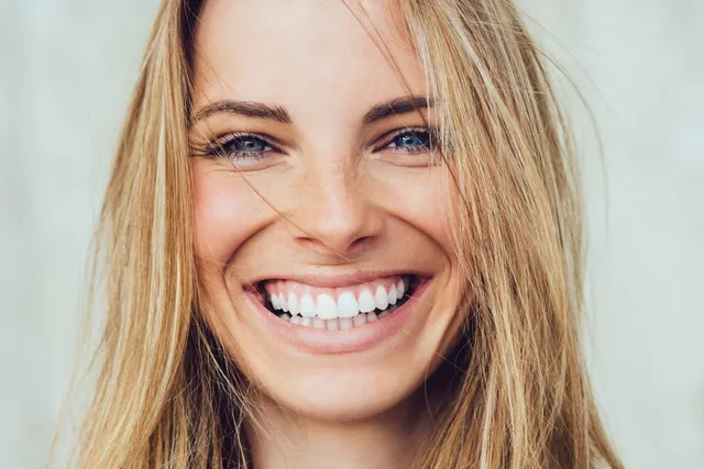 Cosmetic Dentistry Options to Achieve Your Perfect Smile Makeover
