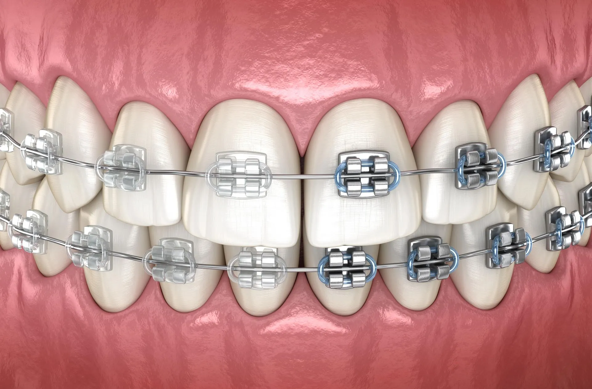 A+ Family Dentistry San Diego County | General, Cosmetic and Emergency